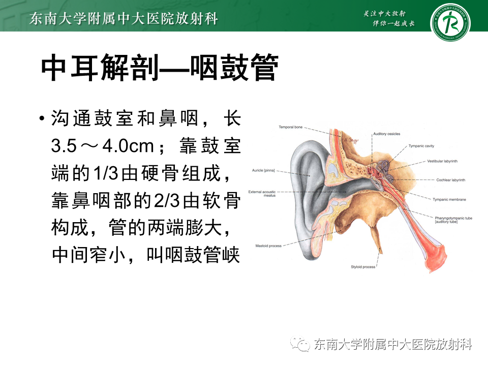 影像PPT - 【PPT】先天性耳发育畸形-9