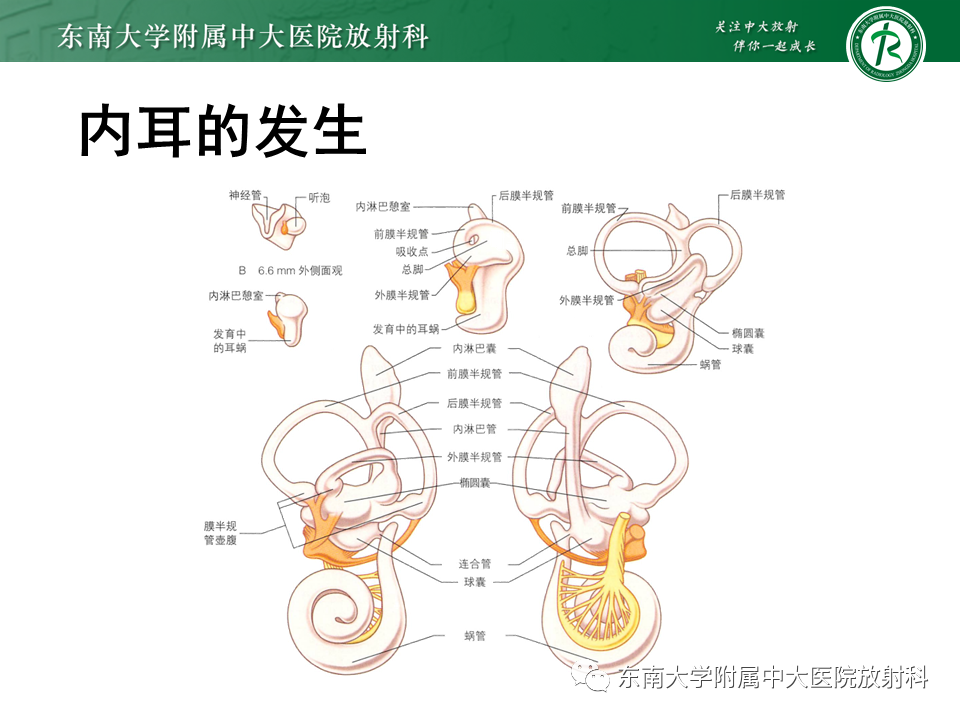 影像PPT - 【PPT】先天性耳发育畸形-11