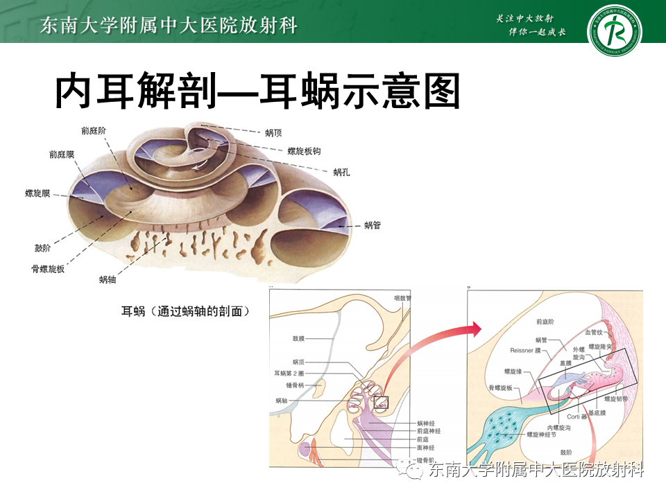 影像PPT - 【PPT】先天性耳发育畸形-15