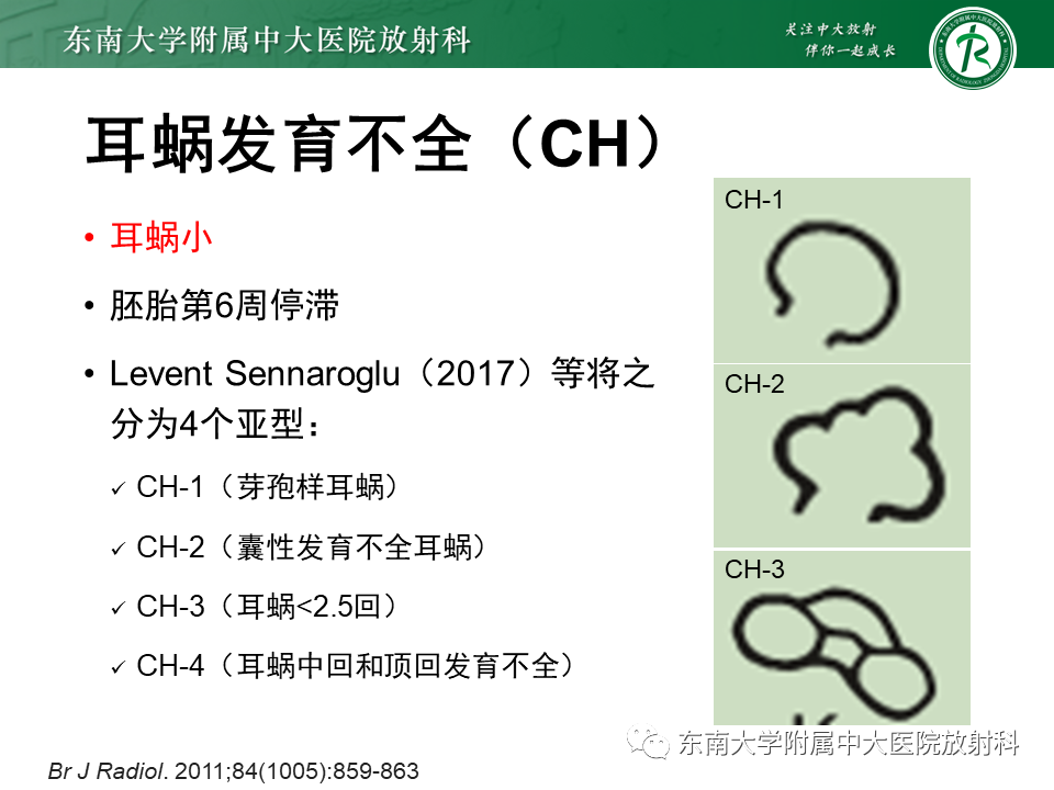 影像PPT - 【PPT】先天性耳发育畸形-31