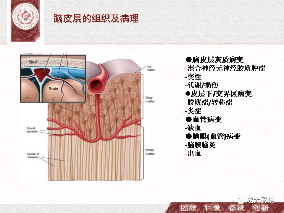 影像PPT - 【PPT】DWI示弥漫性脑皮质高信号病变的鉴别诊断-2