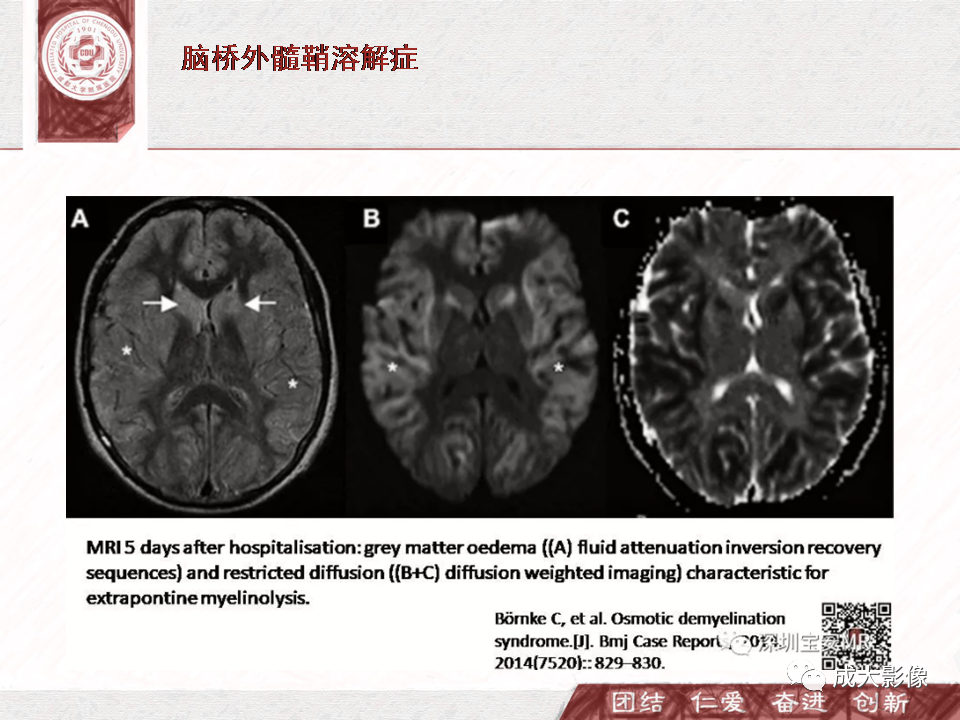 影像PPT - 【PPT】DWI示弥漫性脑皮质高信号病变的鉴别诊断-8