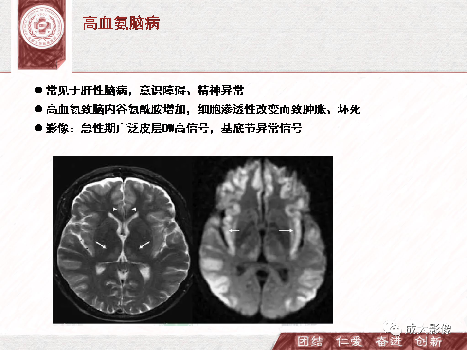 影像PPT - 【PPT】DWI示弥漫性脑皮质高信号病变的鉴别诊断-9