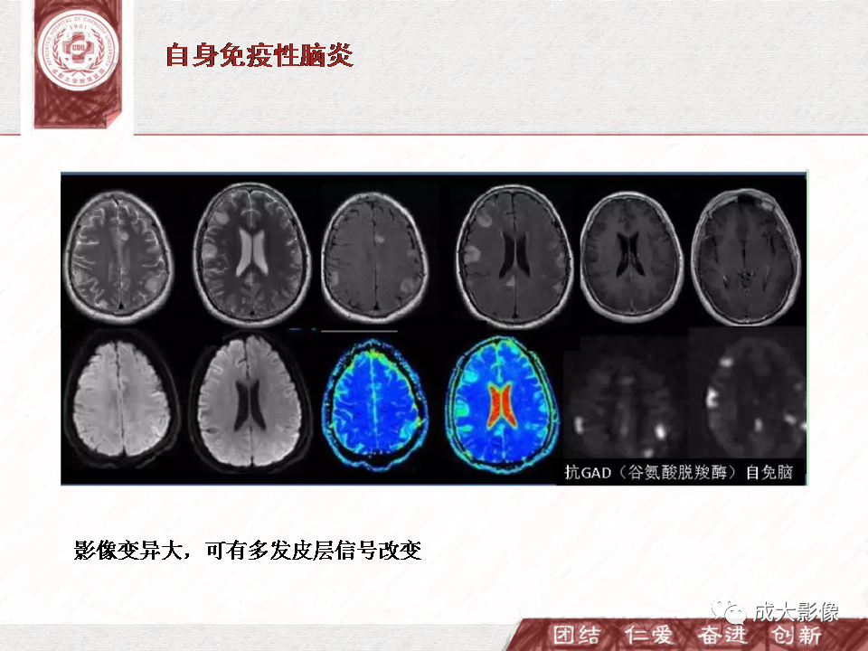 影像PPT - 【PPT】DWI示弥漫性脑皮质高信号病变的鉴别诊断-16