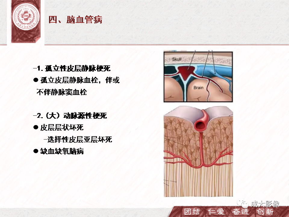 影像PPT - 【PPT】DWI示弥漫性脑皮质高信号病变的鉴别诊断-23