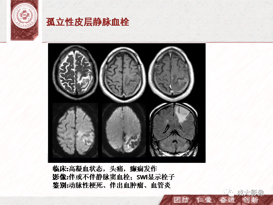影像PPT - 【PPT】DWI示弥漫性脑皮质高信号病变的鉴别诊断-27