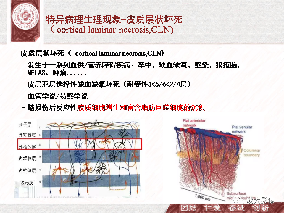 影像PPT - 【PPT】DWI示弥漫性脑皮质高信号病变的鉴别诊断-30