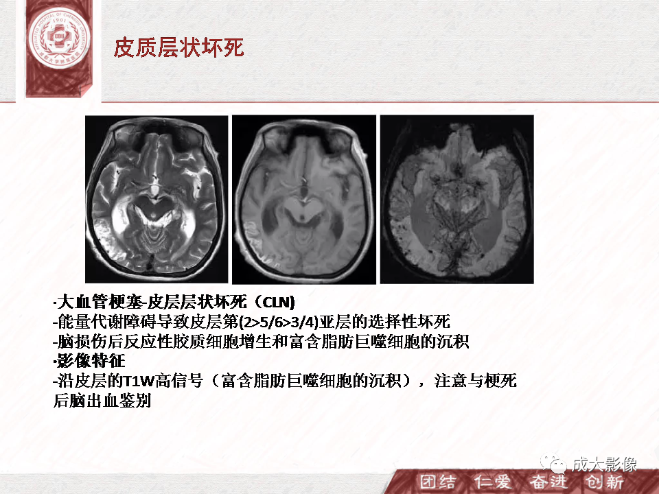 影像PPT - 【PPT】DWI示弥漫性脑皮质高信号病变的鉴别诊断-31