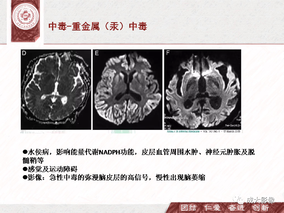 影像PPT - 【PPT】DWI示弥漫性脑皮质高信号病变的鉴别诊断-35