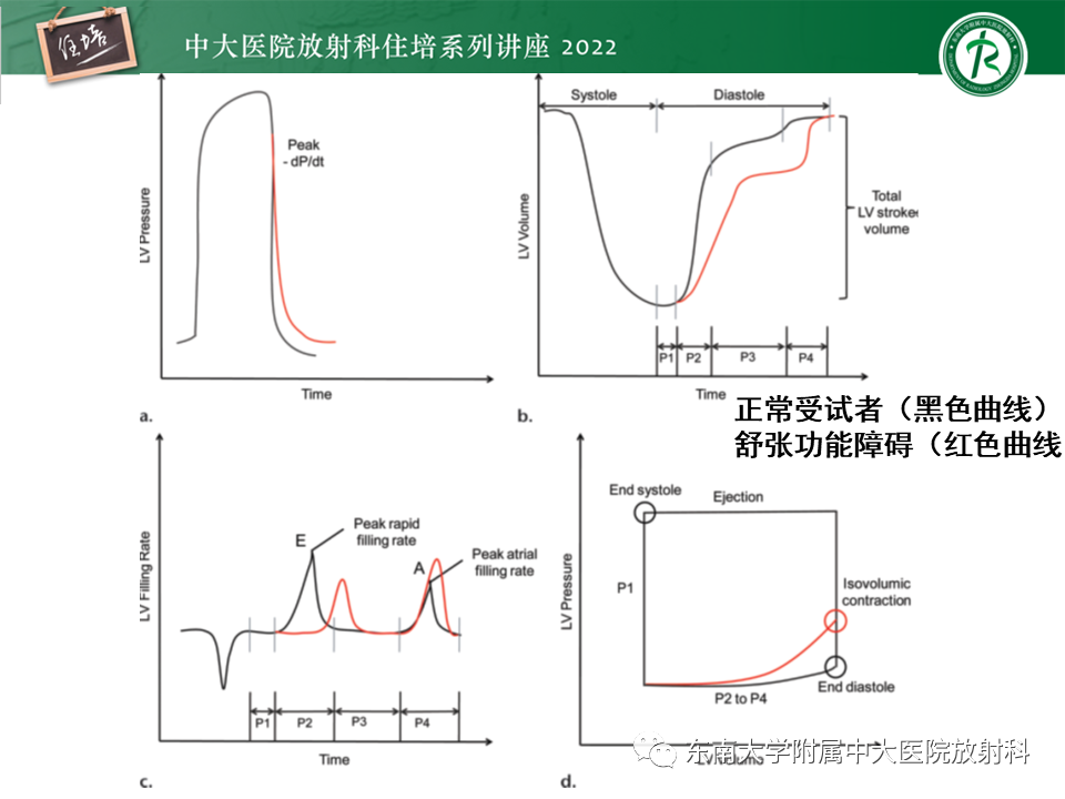 影像PPT - 【PPT】心脏磁共振评估左室舒张功能-11