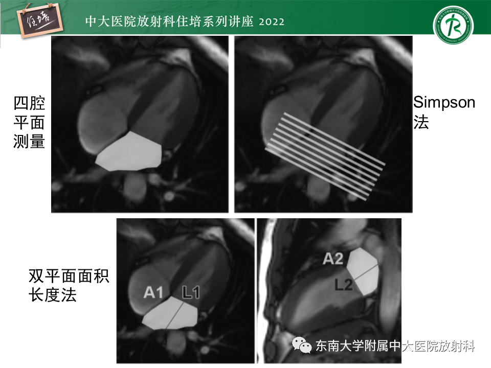 影像PPT - 【PPT】心脏磁共振评估左室舒张功能-16