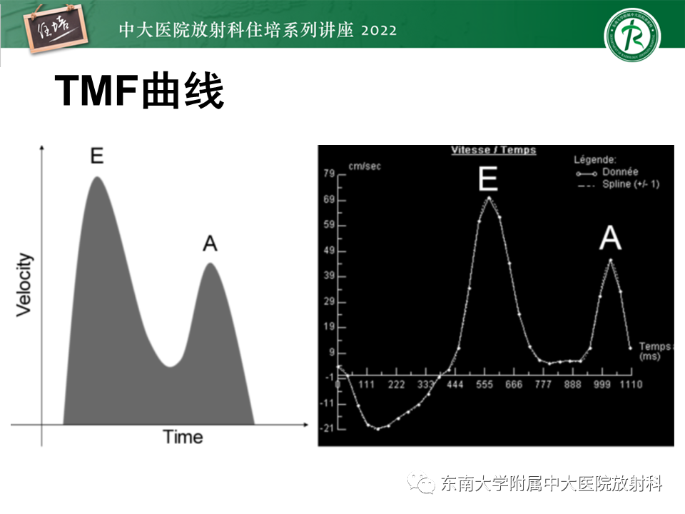 影像PPT - 【PPT】心脏磁共振评估左室舒张功能-20