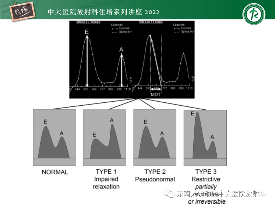 影像PPT - 【PPT】心脏磁共振评估左室舒张功能-22