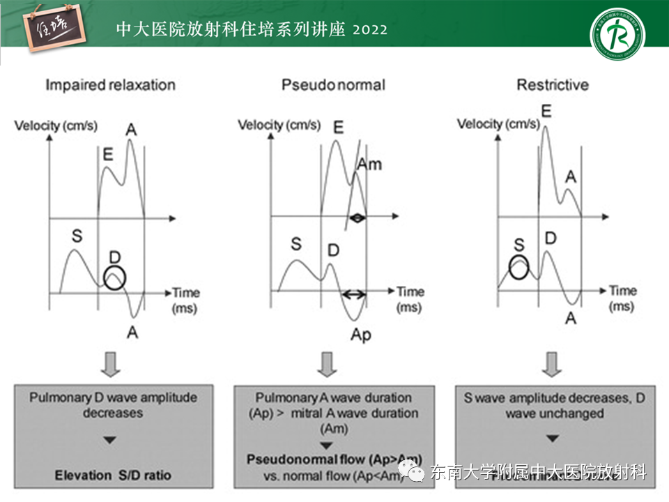 影像PPT - 【PPT】心脏磁共振评估左室舒张功能-31