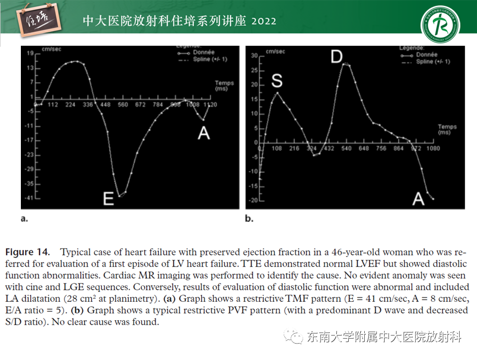 影像PPT - 【PPT】心脏磁共振评估左室舒张功能-32