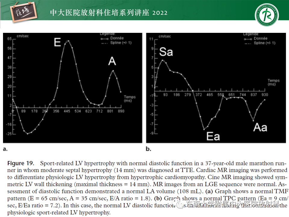 影像PPT - 【PPT】心脏磁共振评估左室舒张功能-39