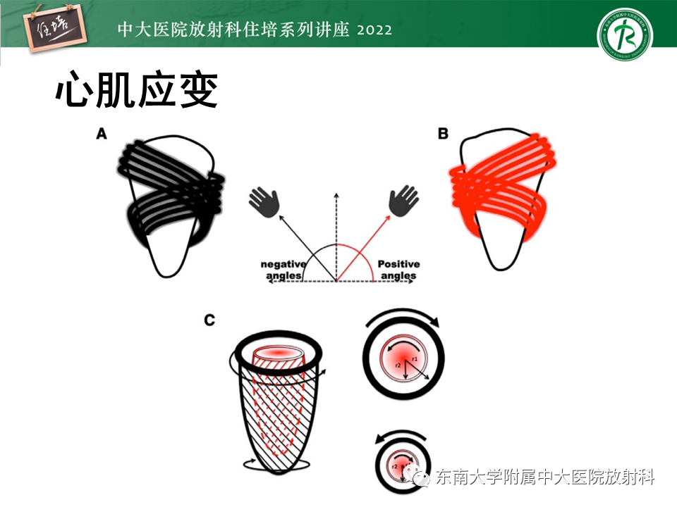 影像PPT - 【PPT】心脏磁共振评估左室舒张功能-42