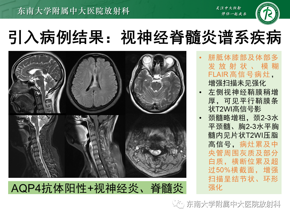 影像PPT - 【PPT】视神经脊髓炎谱系疾病-2 影像PPT - 【PPT】视神经脊髓炎谱系疾病-2