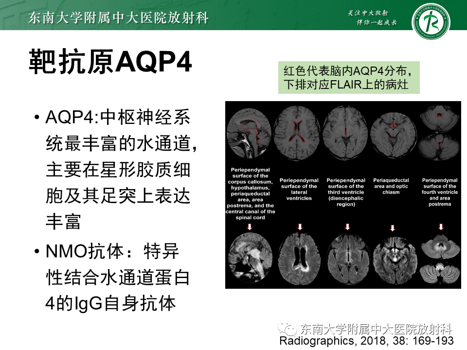 影像PPT - 【PPT】视神经脊髓炎谱系疾病-6 影像PPT - 【PPT】视神经脊髓炎谱系疾病-6