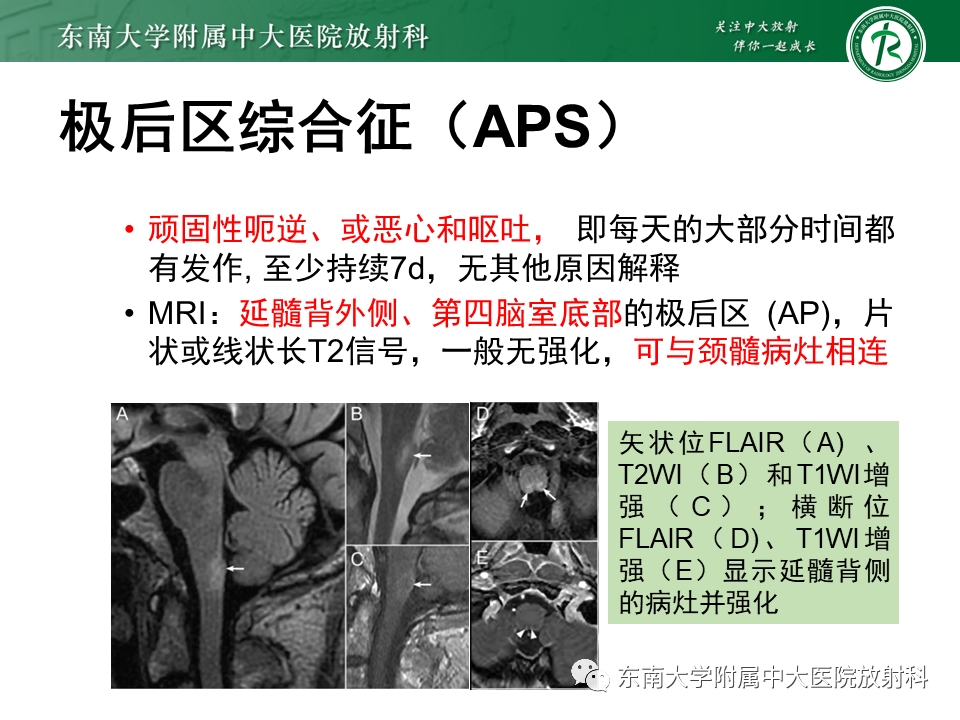 影像PPT - 【PPT】视神经脊髓炎谱系疾病-15 影像PPT - 【PPT】视神经脊髓炎谱系疾病-15