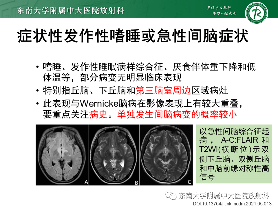 影像PPT - 【PPT】视神经脊髓炎谱系疾病-19 影像PPT - 【PPT】视神经脊髓炎谱系疾病-19