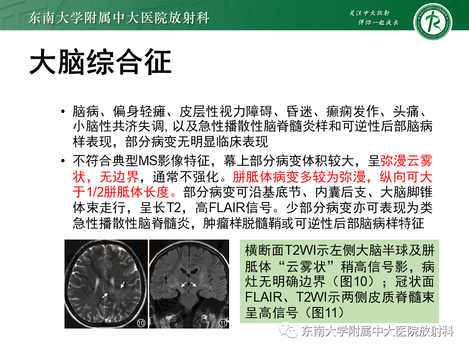 影像PPT - 【PPT】视神经脊髓炎谱系疾病-21 影像PPT - 【PPT】视神经脊髓炎谱系疾病-21