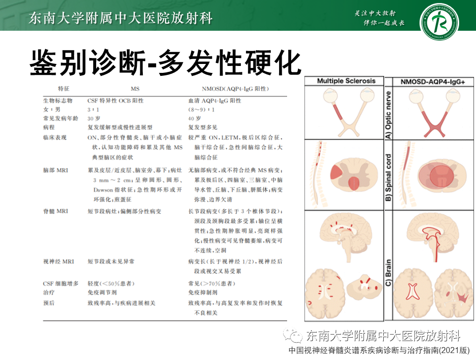 影像PPT - 【PPT】视神经脊髓炎谱系疾病-29 影像PPT - 【PPT】视神经脊髓炎谱系疾病-29
