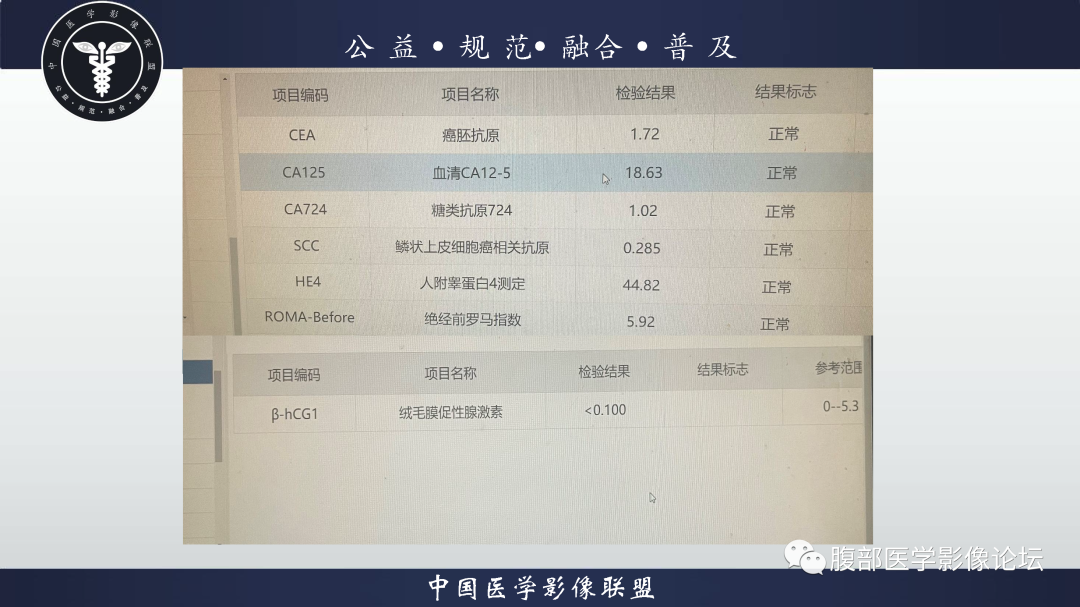 影像PPT - 【病例】巨大阔韧带平滑肌瘤1例CT影像表现-10