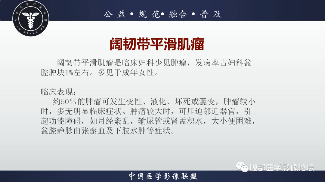 影像PPT - 【病例】巨大阔韧带平滑肌瘤1例CT影像表现-12