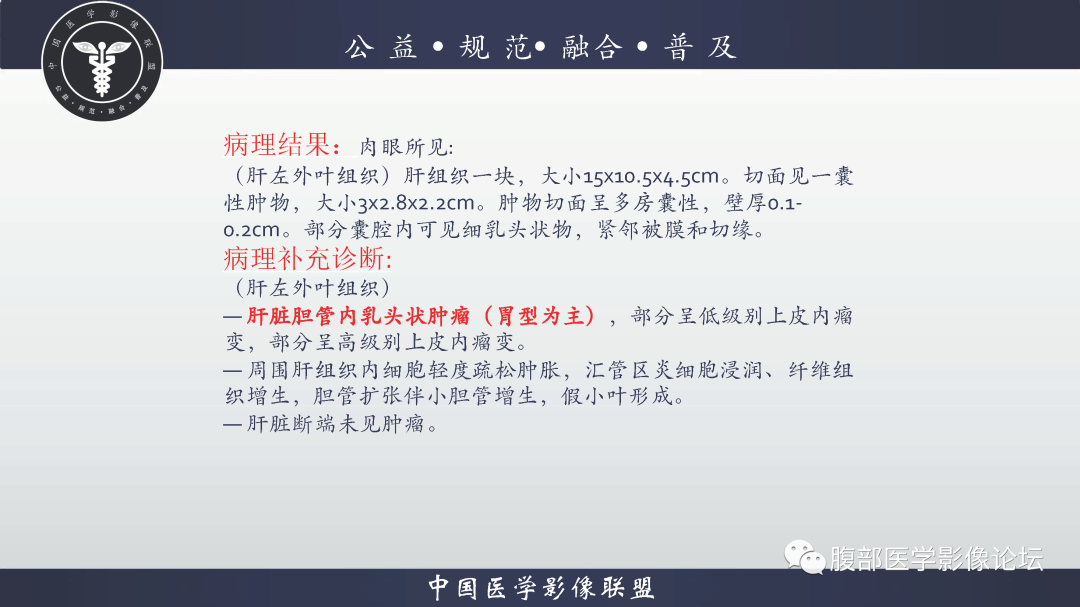 影像PPT - 【病例】巨大阔韧带平滑肌瘤1例CT影像表现-24