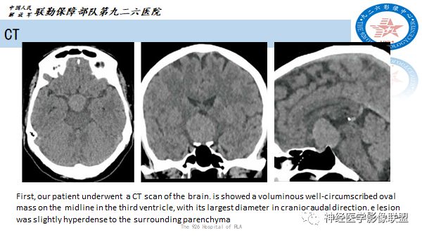 影像PPT - 【病例】八字水肿征—脊索样胶质瘤1例影像表现分析-1 影像PPT - 【病例】八字水肿征—脊索样胶质瘤1例影像表现分析-1