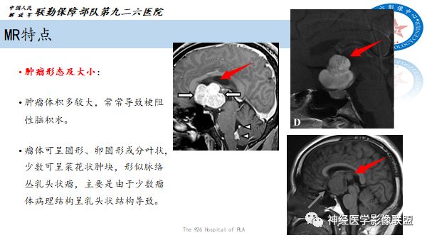 影像PPT - 【病例】八字水肿征—脊索样胶质瘤1例影像表现分析-12 影像PPT - 【病例】八字水肿征—脊索样胶质瘤1例影像表现分析-12