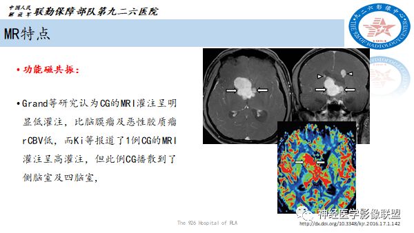 影像PPT - 【病例】八字水肿征—脊索样胶质瘤1例影像表现分析-19 影像PPT - 【病例】八字水肿征—脊索样胶质瘤1例影像表现分析-19