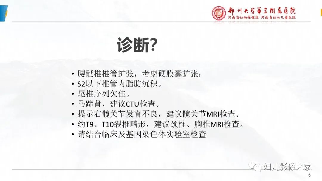 影像PPT - 【PPT】Kabuki综合征的影像诊断-6