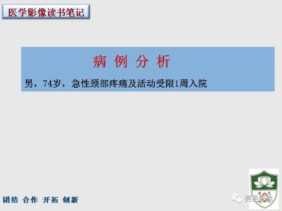影像PPT - 【PPT】齿状突加冠综合征-2