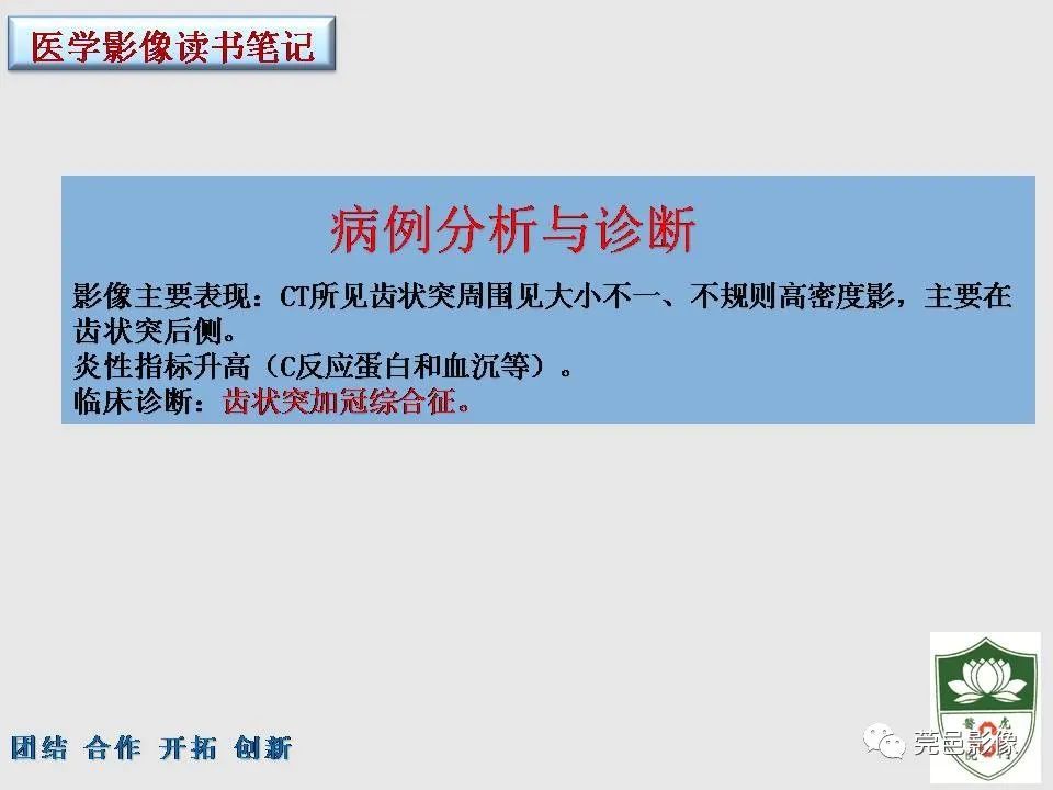 影像PPT - 【PPT】齿状突加冠综合征-6
