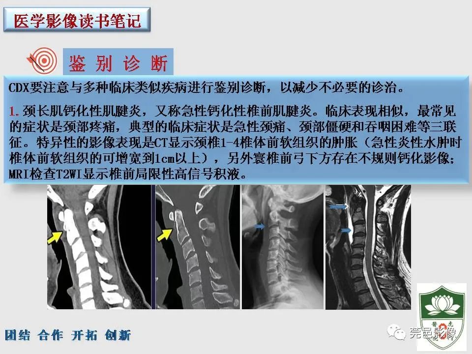 影像PPT - 【PPT】齿状突加冠综合征-15
