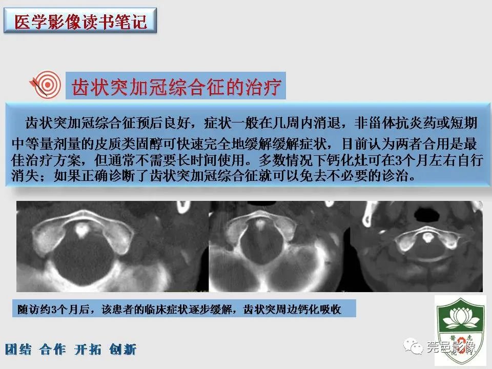影像PPT - 【PPT】齿状突加冠综合征-17