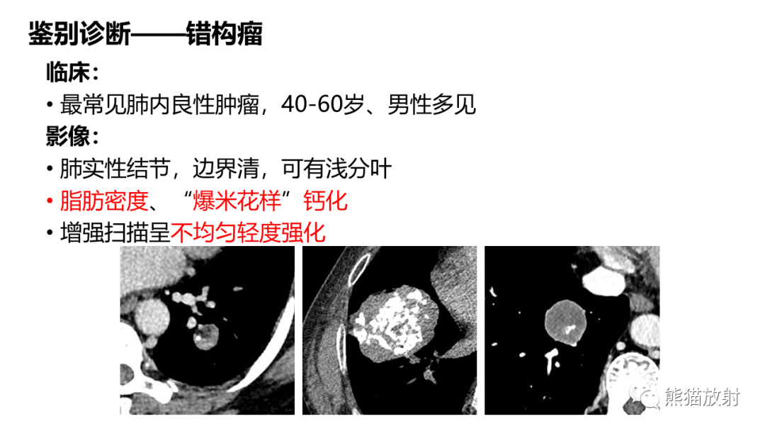 影像PPT - 【病例】肺孤立性纤维瘤 VS 硬化性肺细胞瘤-43
