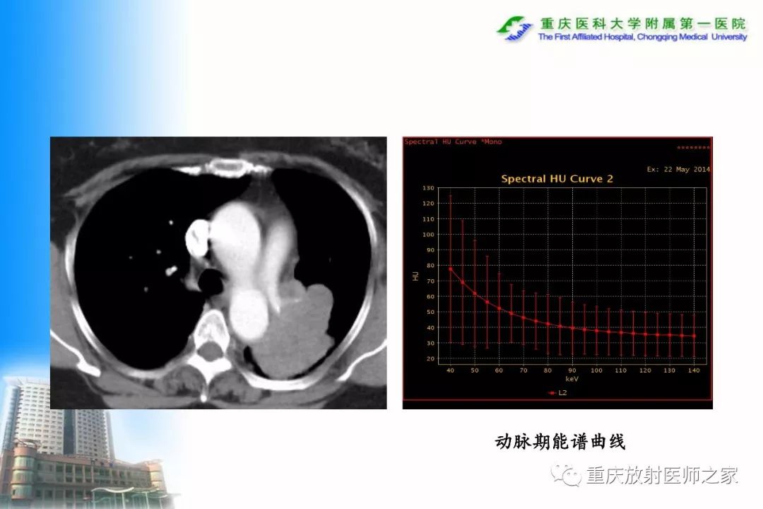 影像PPT - 【PPT】碘对比剂CT增强的影响因素与临床应用-8