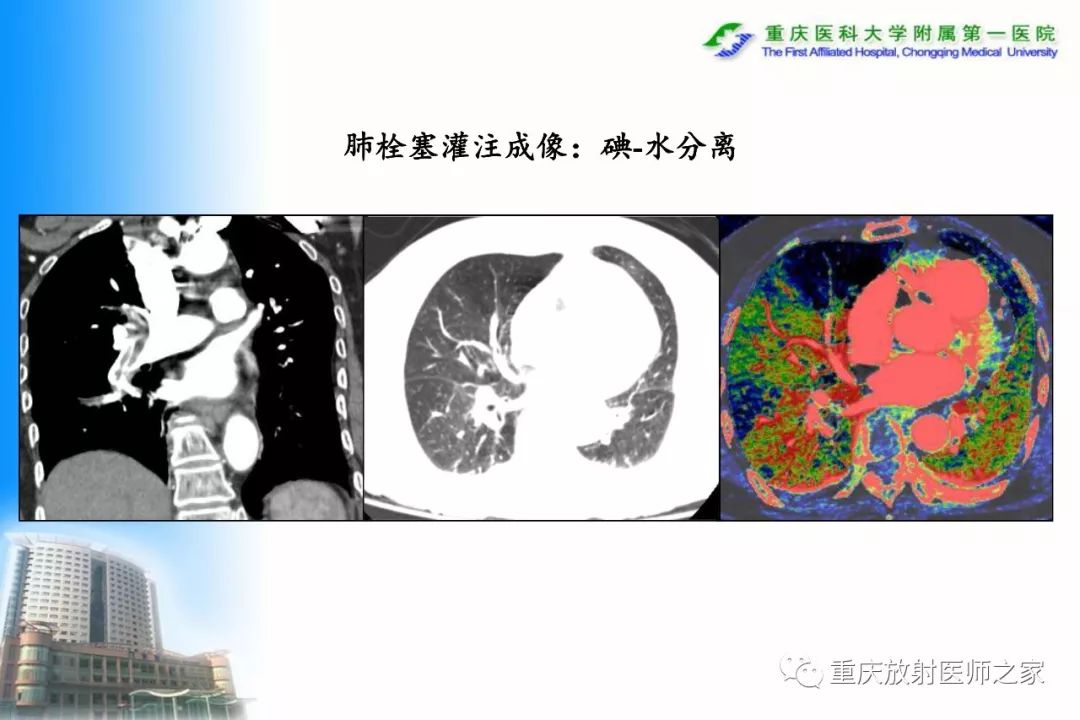 影像PPT - 【PPT】碘对比剂CT增强的影响因素与临床应用-10