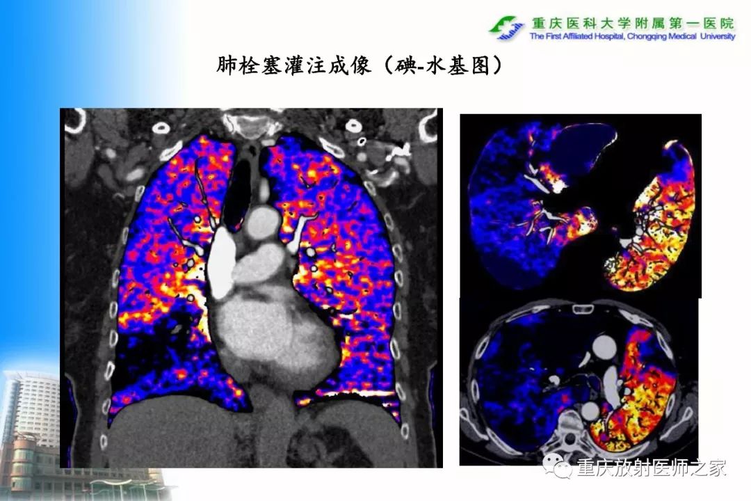 影像PPT - 【PPT】碘对比剂CT增强的影响因素与临床应用-11