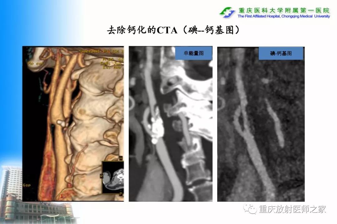 影像PPT - 【PPT】碘对比剂CT增强的影响因素与临床应用-12
