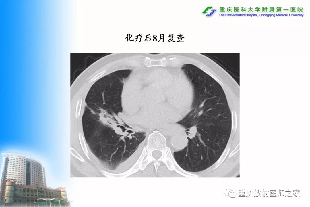 影像PPT - 【PPT】碘对比剂CT增强的影响因素与临床应用-40