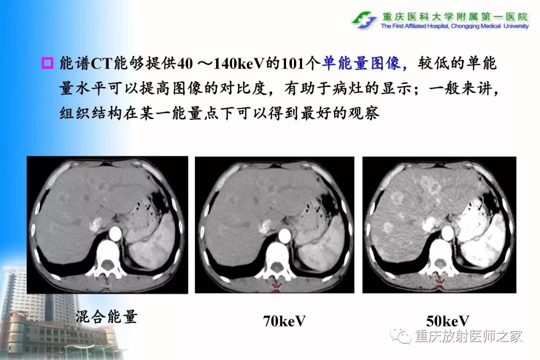 影像PPT - 【PPT】碘对比剂CT增强的影响因素与临床应用-41