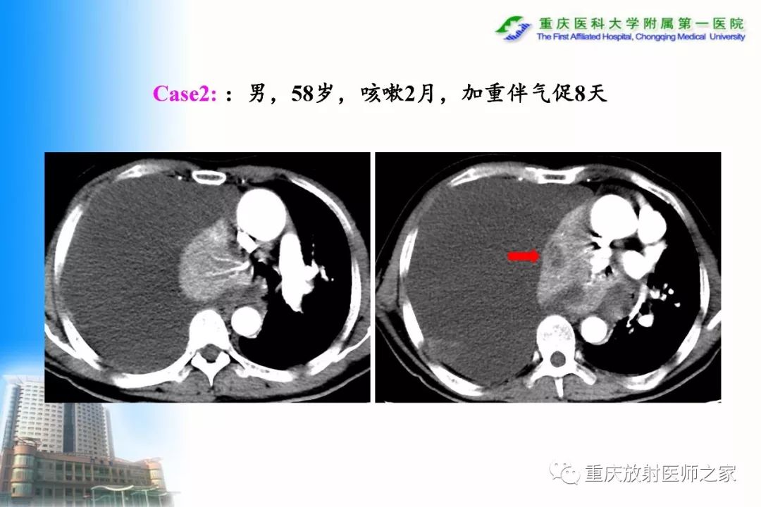 影像PPT - 【PPT】碘对比剂CT增强的影响因素与临床应用-38