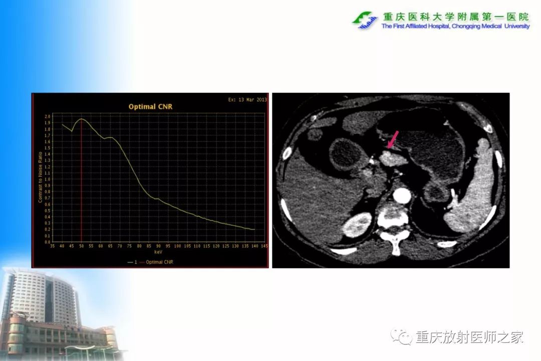 影像PPT - 【PPT】碘对比剂CT增强的影响因素与临床应用-44