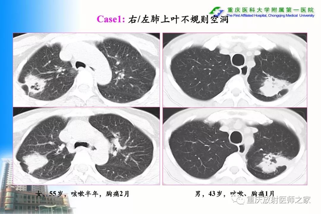影像PPT - 【PPT】碘对比剂CT增强的影响因素与临床应用-49