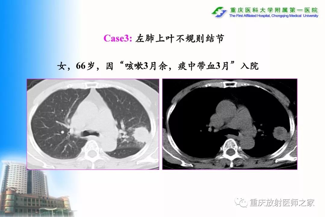 影像PPT - 【PPT】碘对比剂CT增强的影响因素与临床应用-55