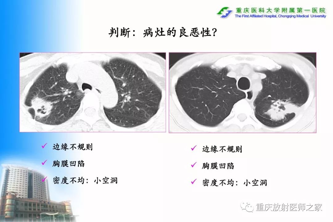 影像PPT - 【PPT】碘对比剂CT增强的影响因素与临床应用-50